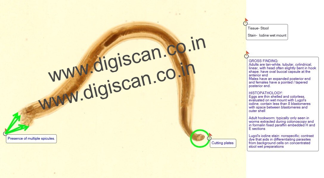 Microbiology & Parasitology Digital Slides Set (Microbial & Parasitic Diseases)